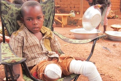 Jovachi Mongonou, 9, had both legs amputated after he suffered severe shrapnel wounds when Seleka soldiers shelled a church in Bangui in April 2013.