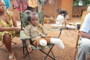 Jovachi Mongonou, 9, had both legs amputated after he suffered severe shrapnel wounds when Seleka soldiers shelled a church in Bangui in April 2013.