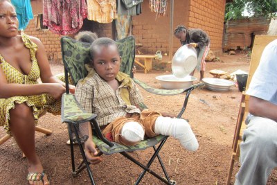 Jovachi Mongonou, 9ans, a perdu ses deux jambes suite au bombardement d'une église à Bangui en avril 2013.