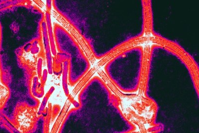 Color-enhanced electron micrograph of Ebola virus.