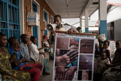 An MSF health promoter explains the signs and symptoms of mpox to camp people present inside the health centre supported by MSF in the Kanyaruchinya displacement site, on the outskirts of Goma. :